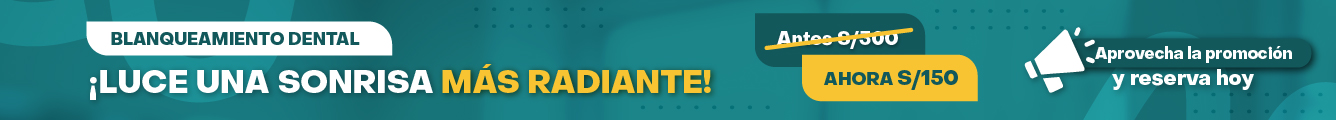Blanqueamiento Dental - Antes S/300 ahora S/150